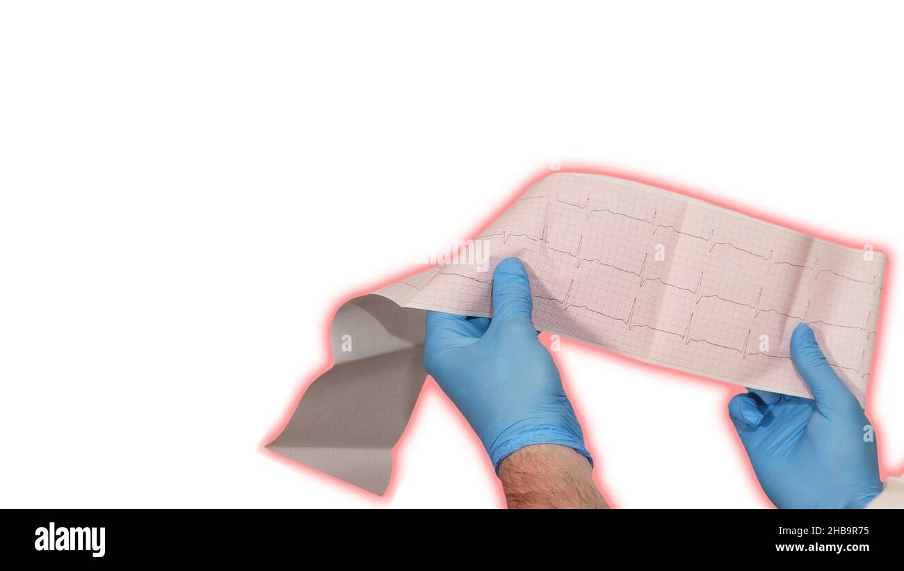 Heart cardiogram in the hands of a doctor. Doctor analyzes heart ...
