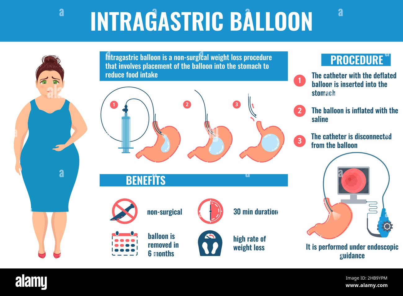 Gastric balloon, conceptual illustration Stock Photo Alamy