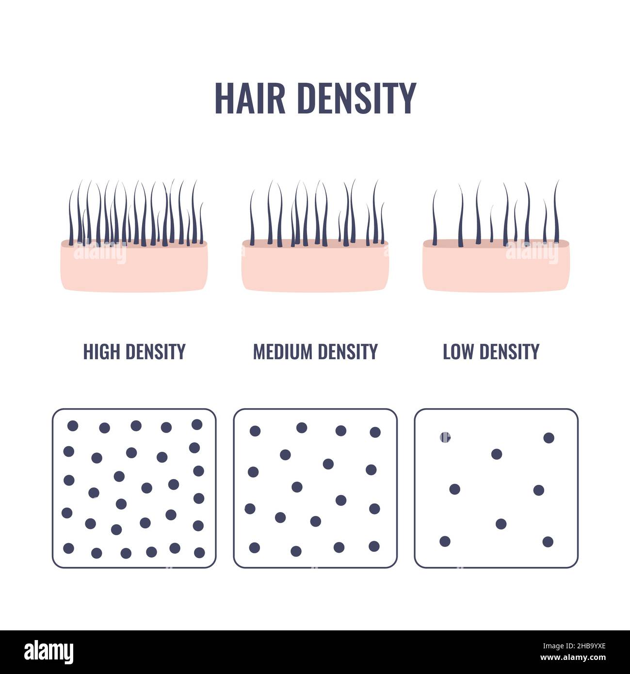 Hair density types, conceptual illustration Stock Photo Alamy
