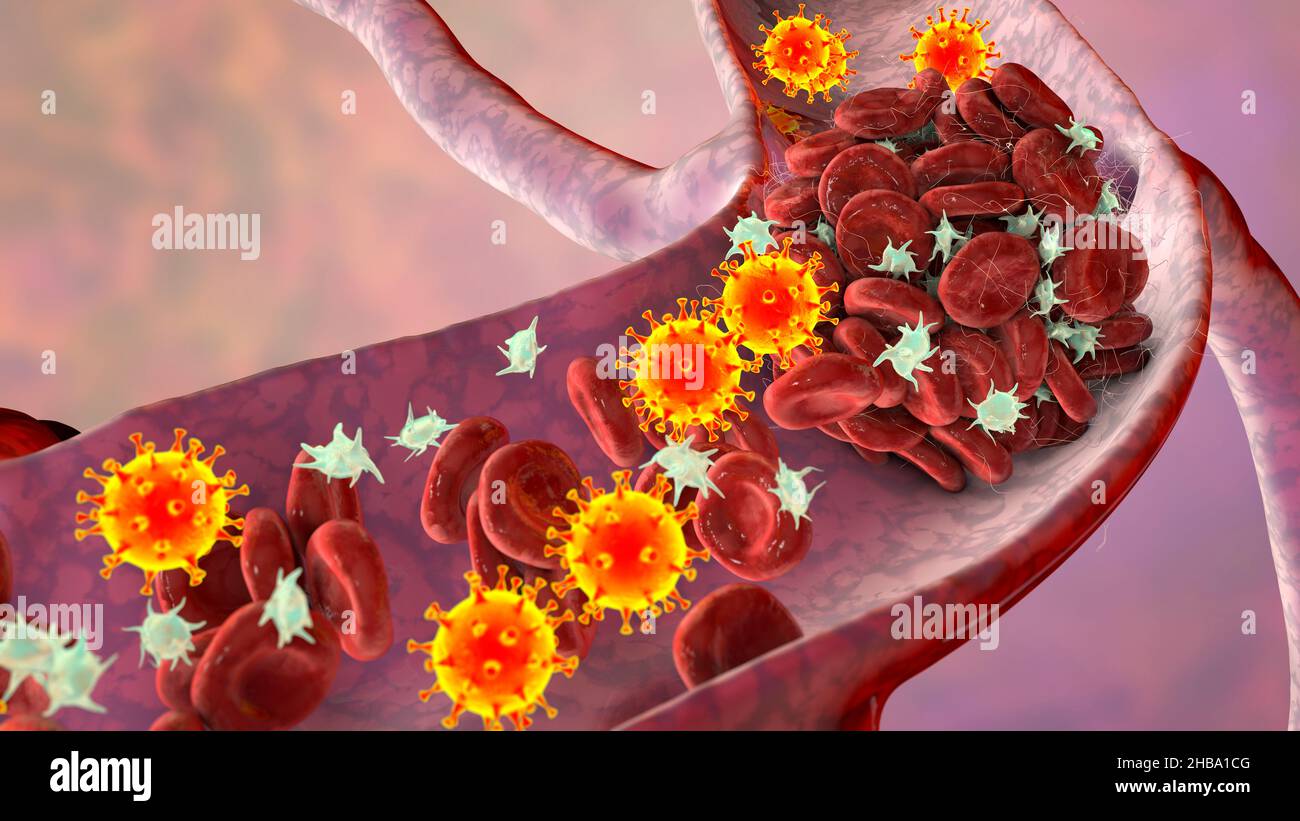 Imagestream Platelets COVID-19 virus particles and activated platelets in blood stream ...