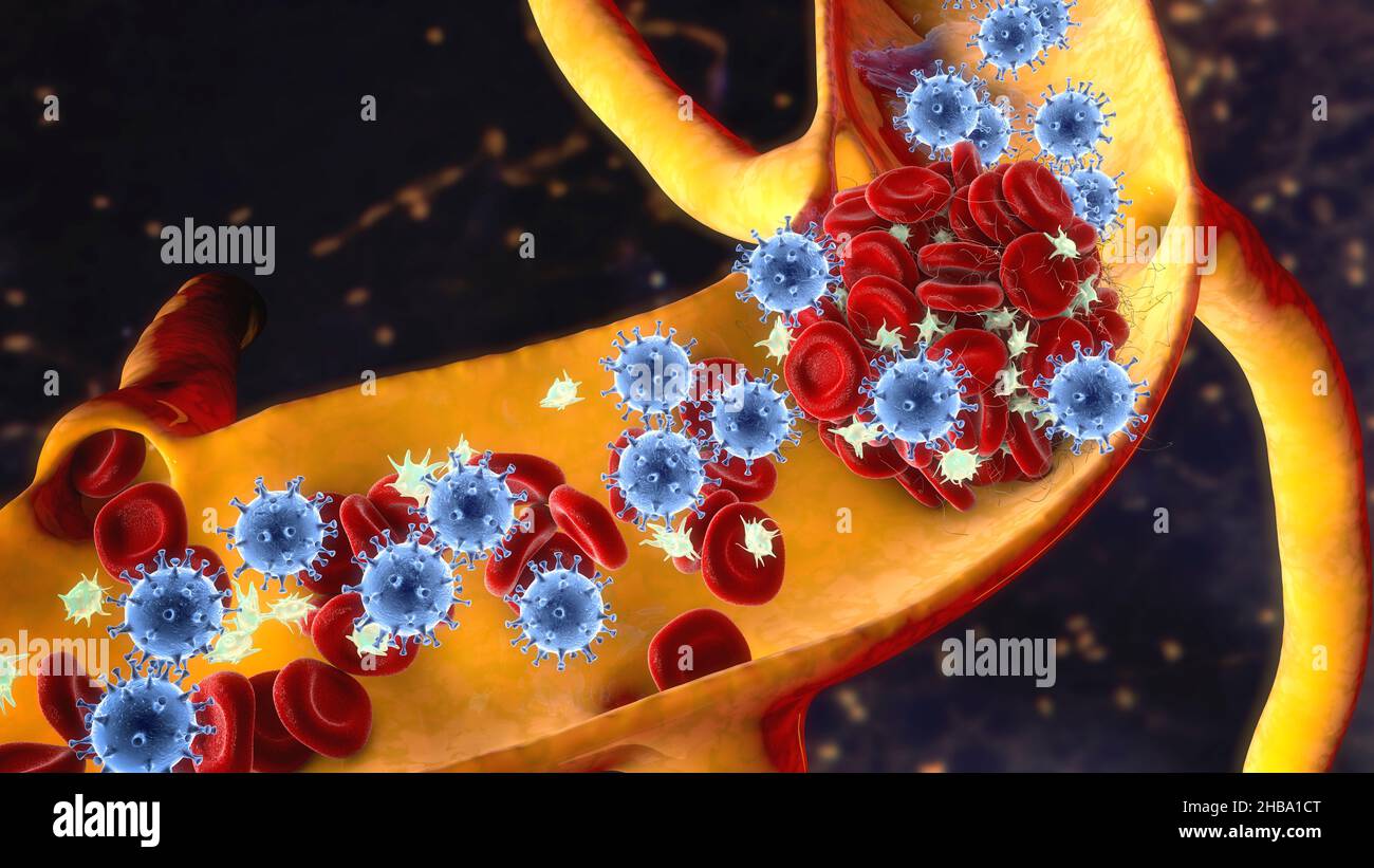 COVID19 virus particles and activated platelets in blood stream