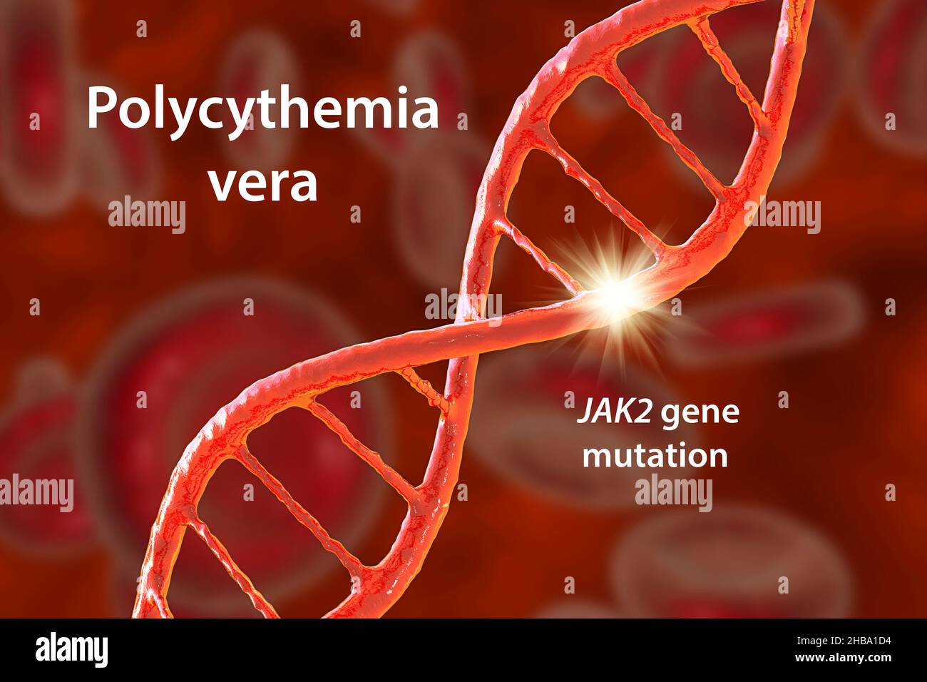 Polycythemia or Too Many Red Blood Cells