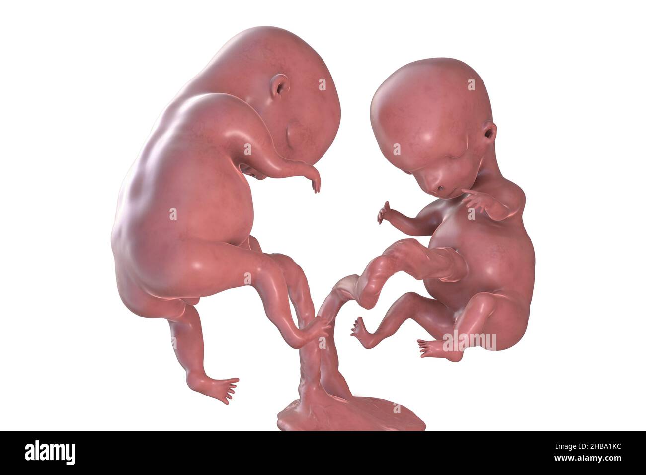 Multiple pregnancy, illustration. Monozygotic twins in the uterus