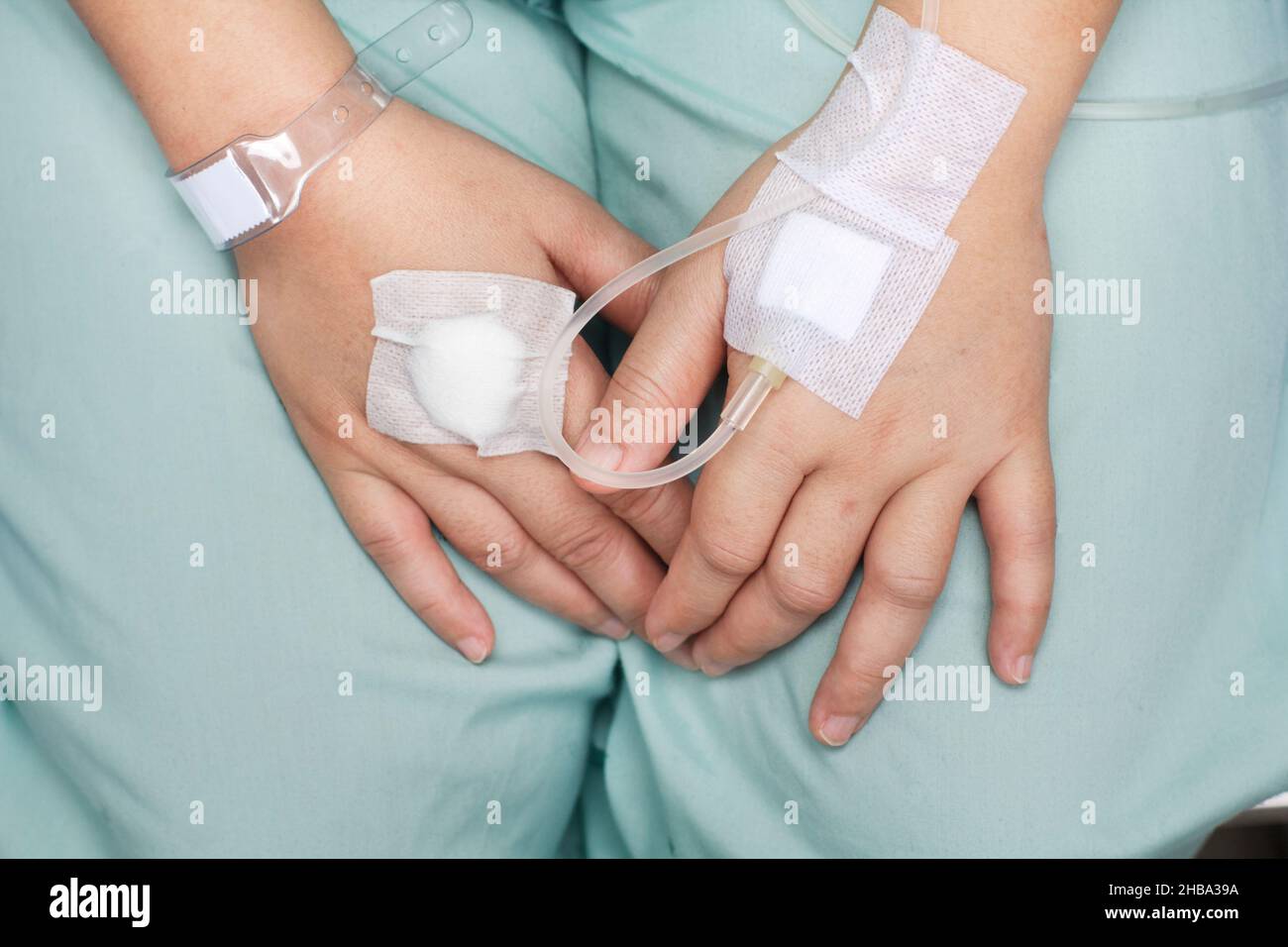 hand swollen by saline intravenous (iv Stock Photo Alamy