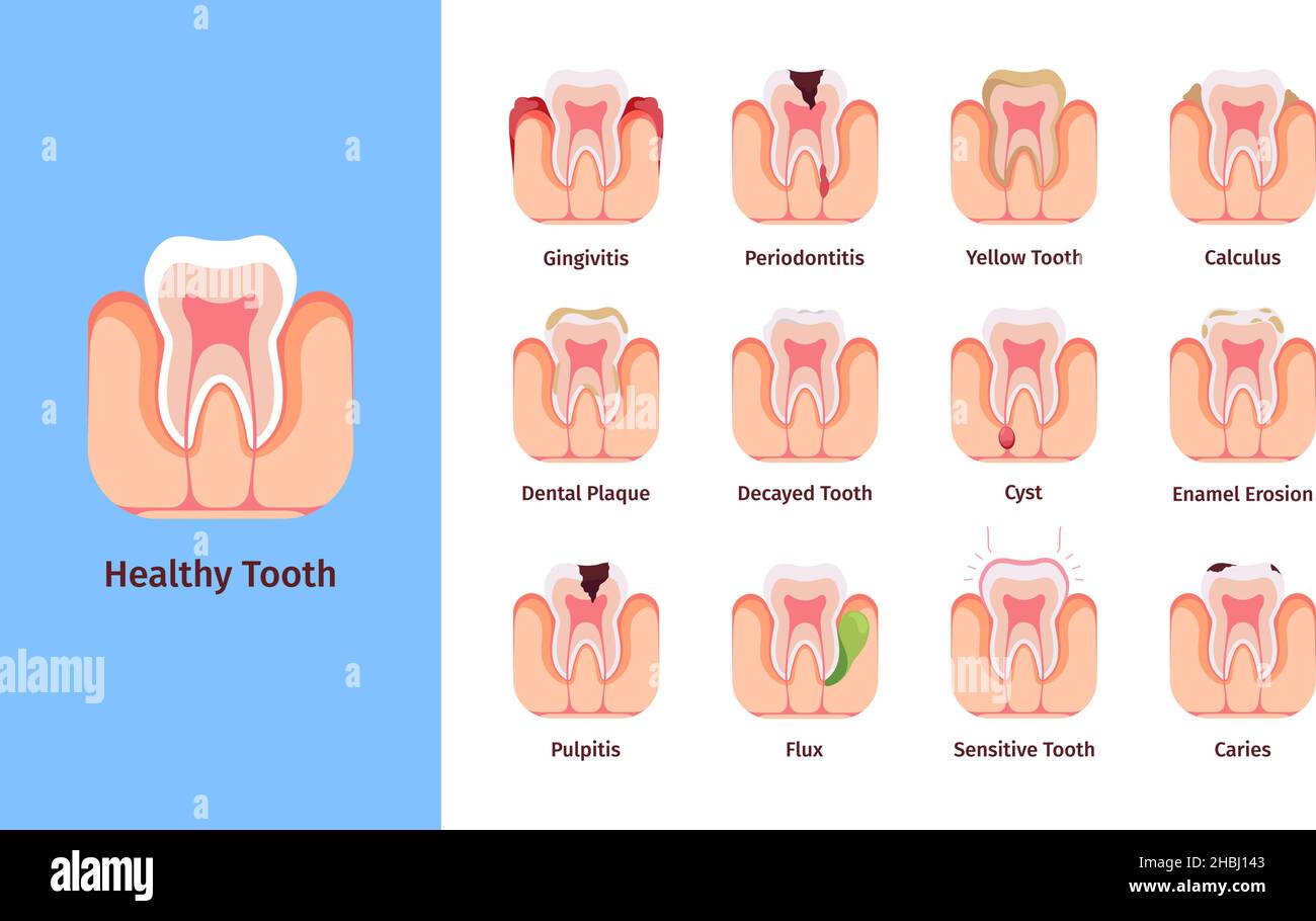 10 Questions On children's dentistry
