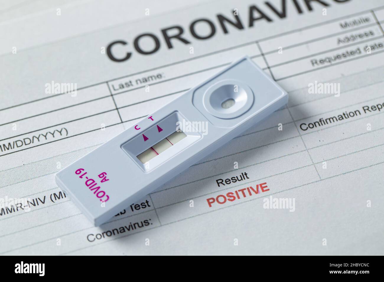 Rapid Antigen Test kit for check coronavirus result is positve with report document.Covid19 Ag