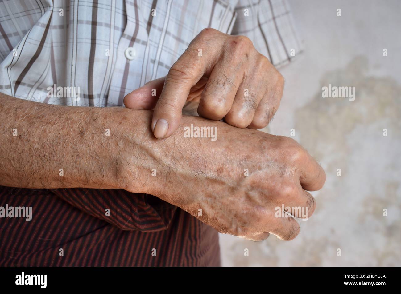 Wrist joint of Asian, Myanmar elder man. Concept of joint pain