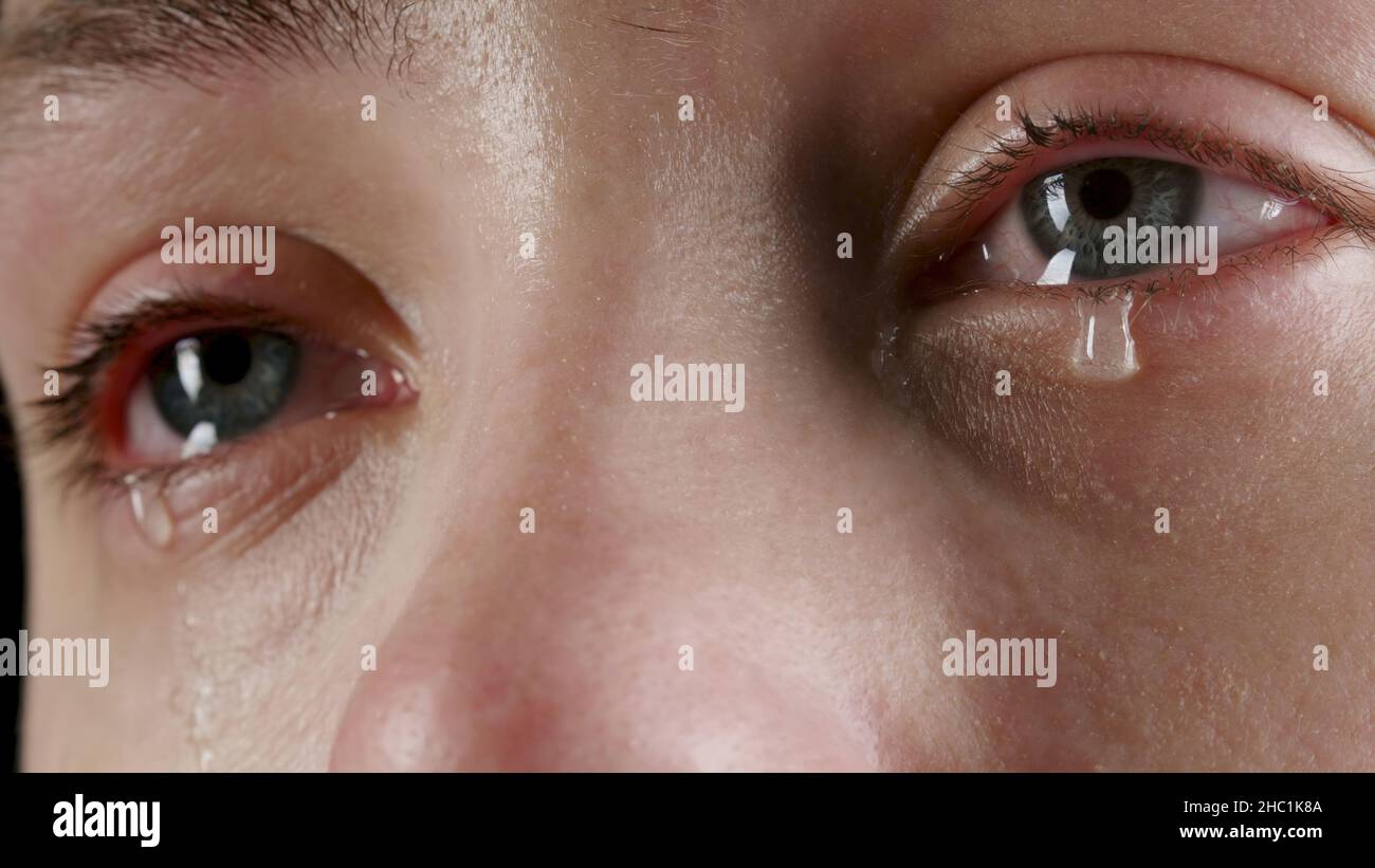 Closeup image of the woman's tearing eye Stock Photo Alamy