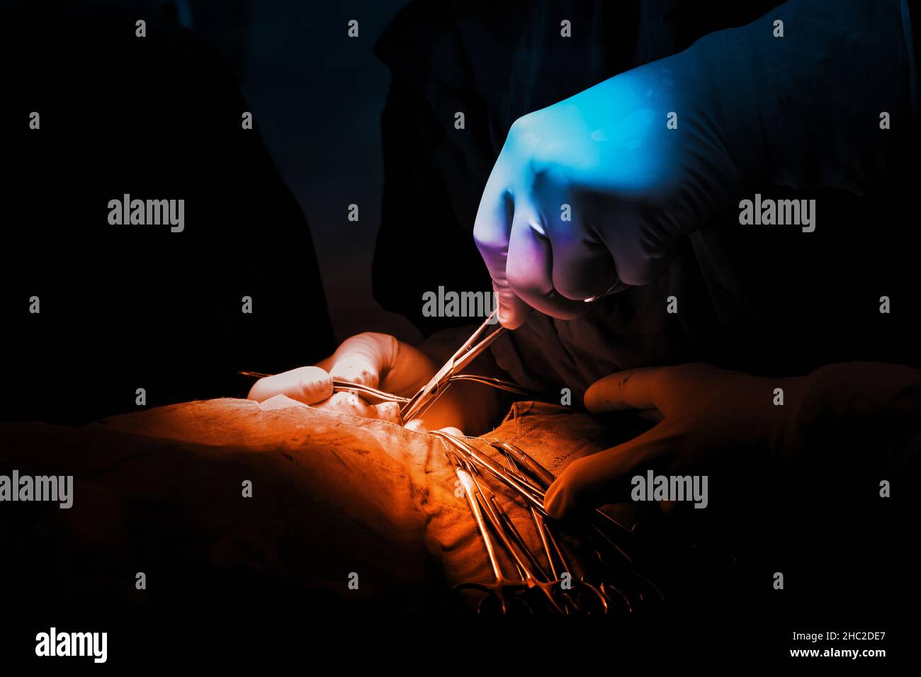 Pictures of surgery performed by a specialist surgeon. Color tones distinguish blue and orange. Stock Photo