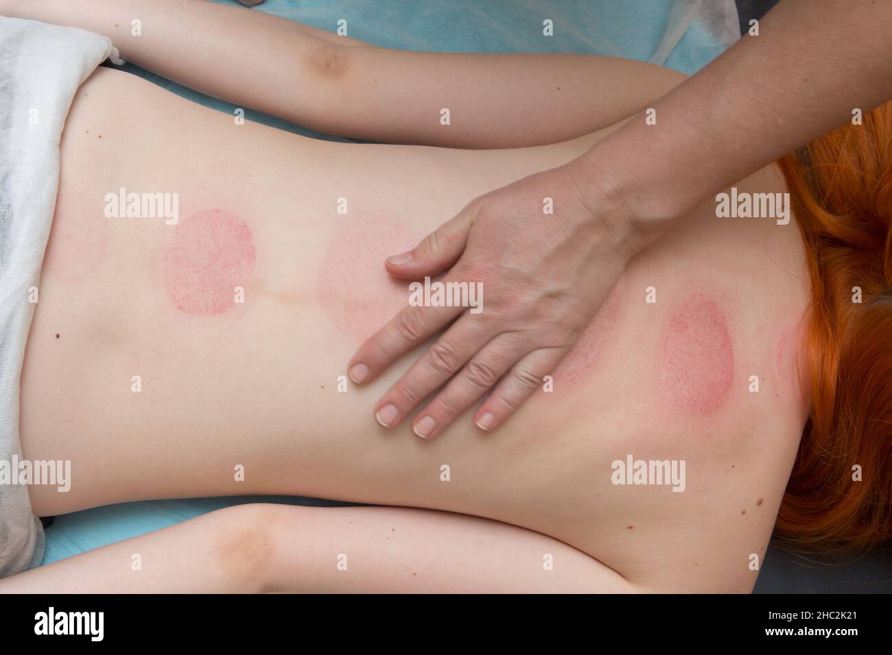 medical therapeutic back massage, relaxation of the back muscles Stock Photo