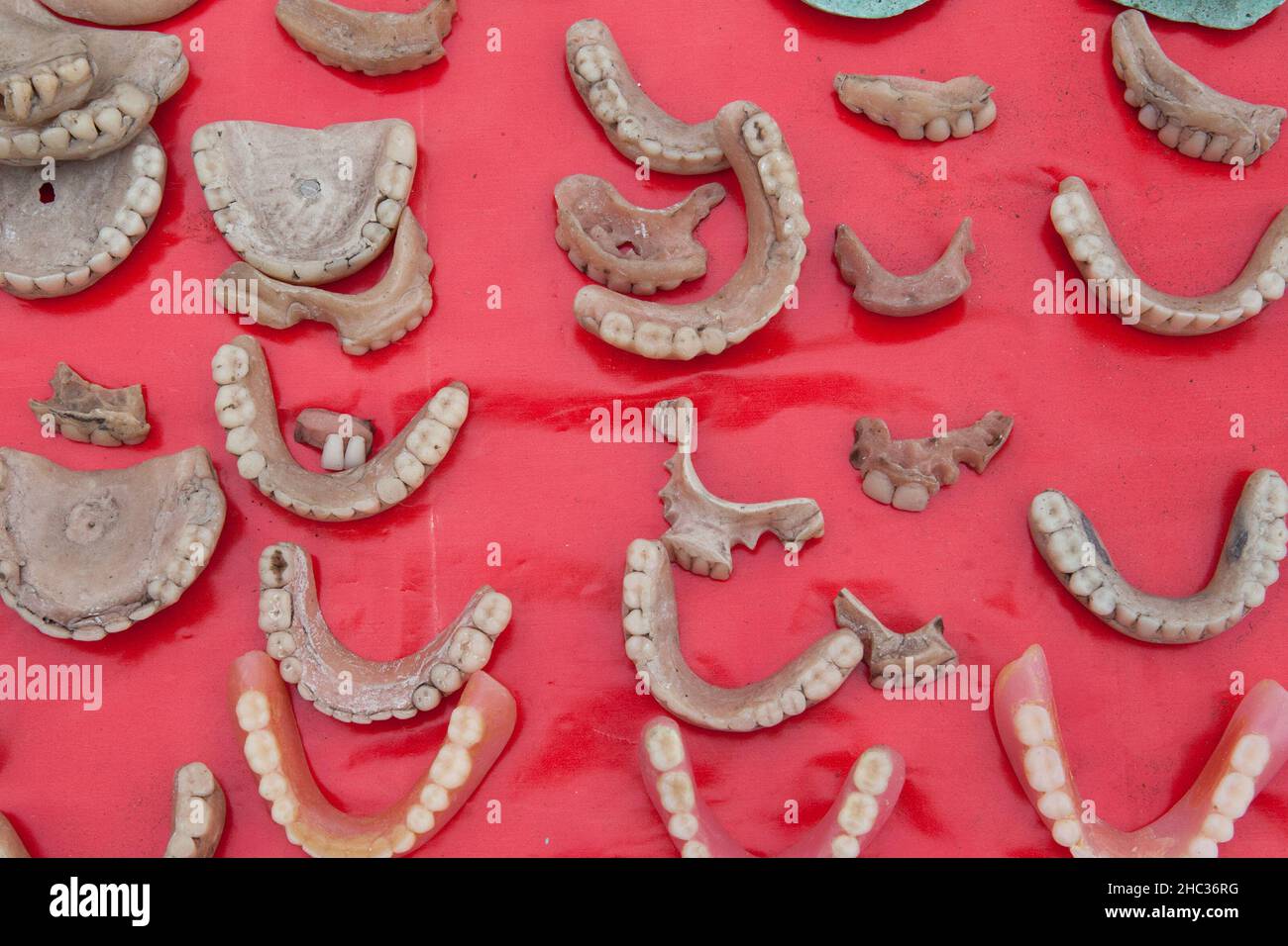 Display of dental moulds and false teeth in Asansol, India Stock Photo
