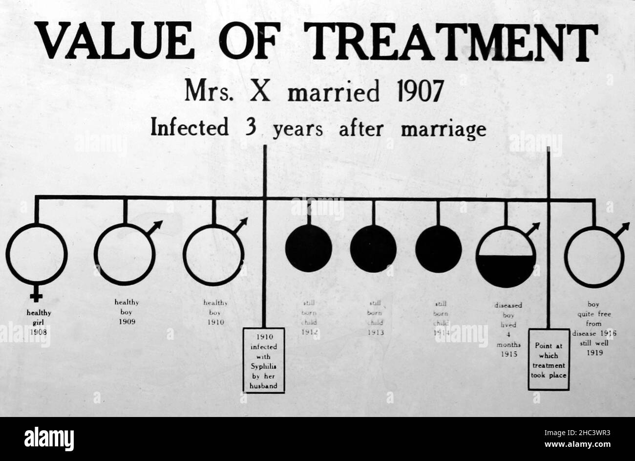 Syphilis treatment, 1920s projection slide Stock Photo