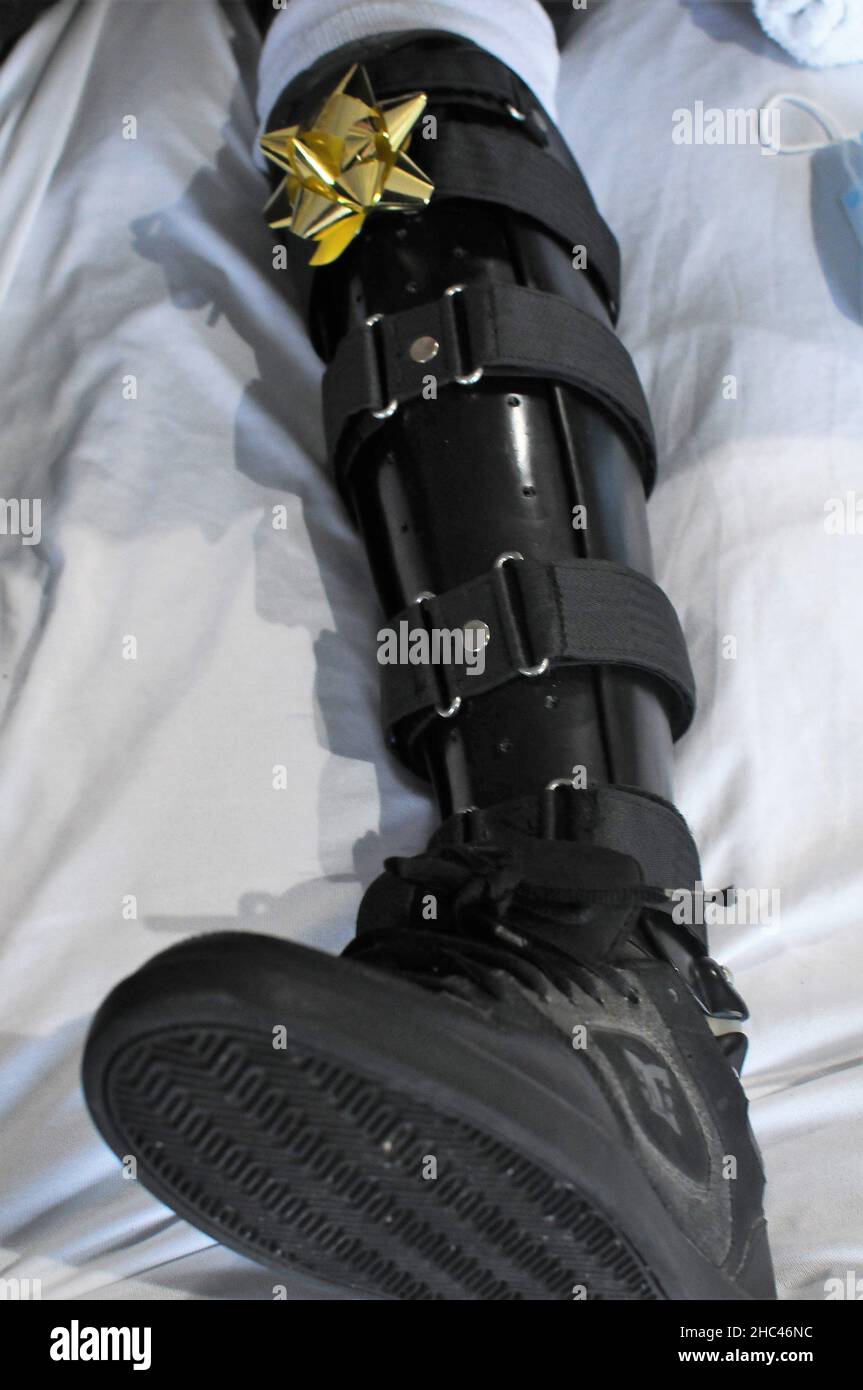 A boy wearing a leg brace in hospital during the Christmas holidays in Vancouver, BC, Canada. Stock Photo