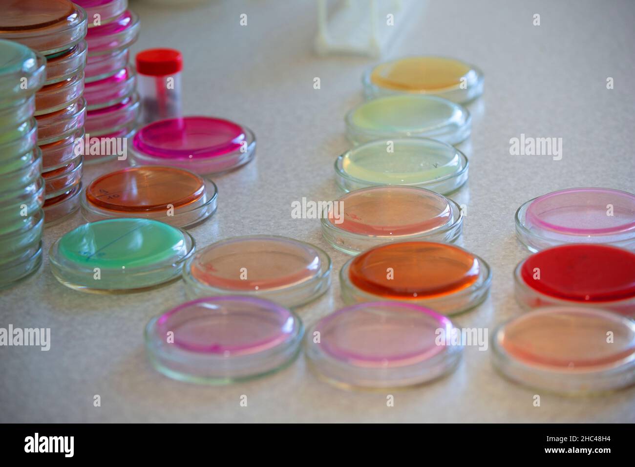 Bacterial colonies of streptococci with alpha hemolytics on a blood