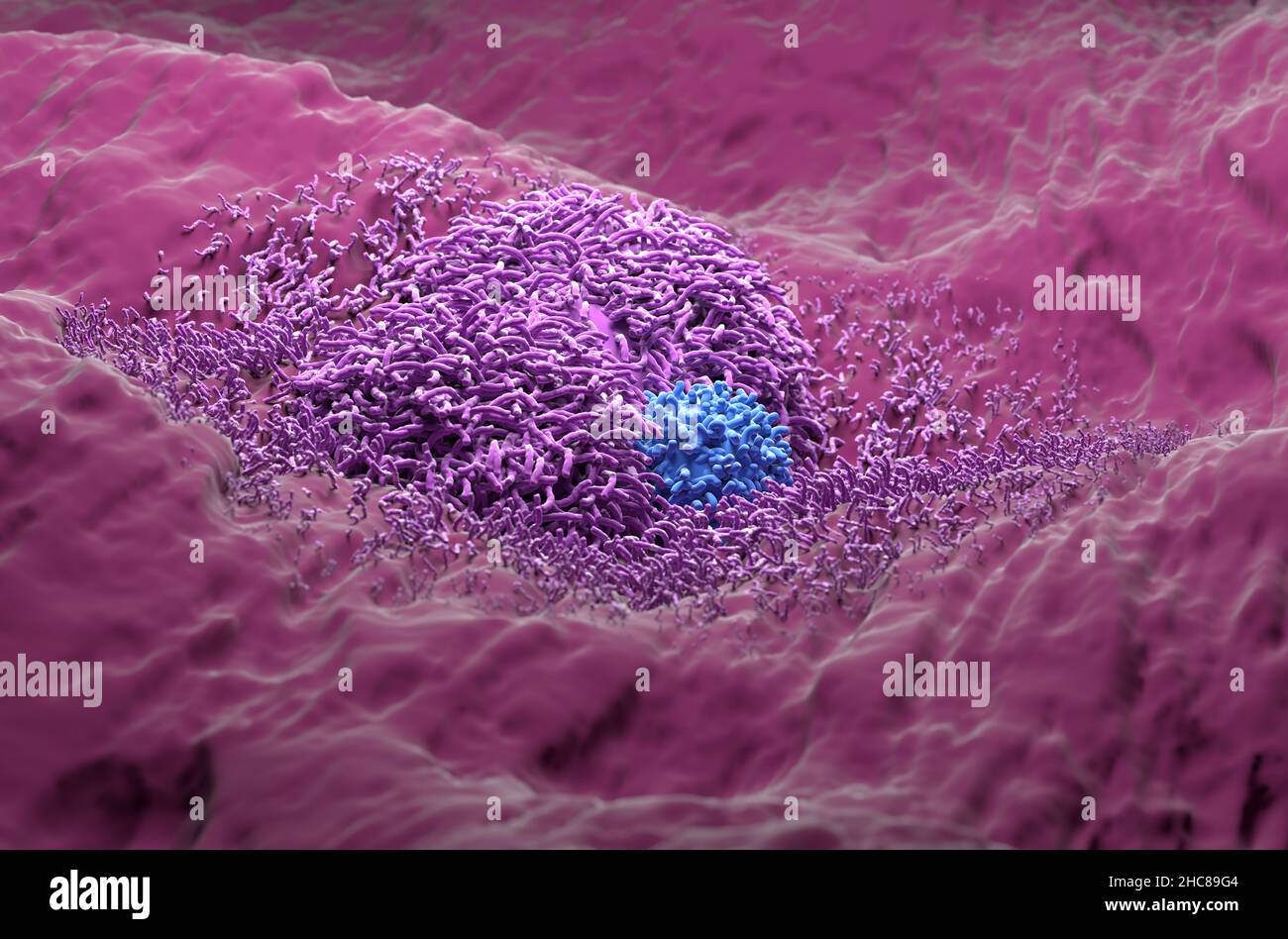 Liver cancer hepatoma with t-cell realistic colseup view 3d illustration Stock Photo