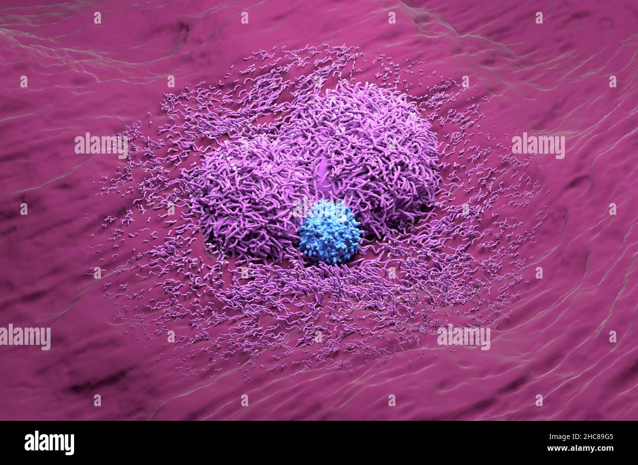 Liver cancer hepatoma with t-cell realistic isometric view 3d illustration Stock Photo