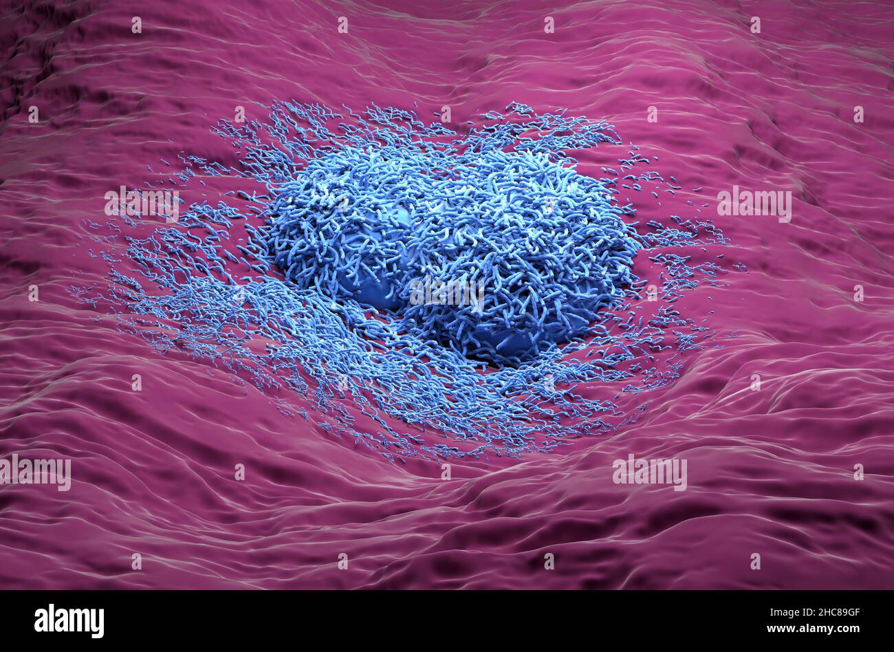 Liver cancer hepatoma blue color realistic side view 3d illustration Stock Photo