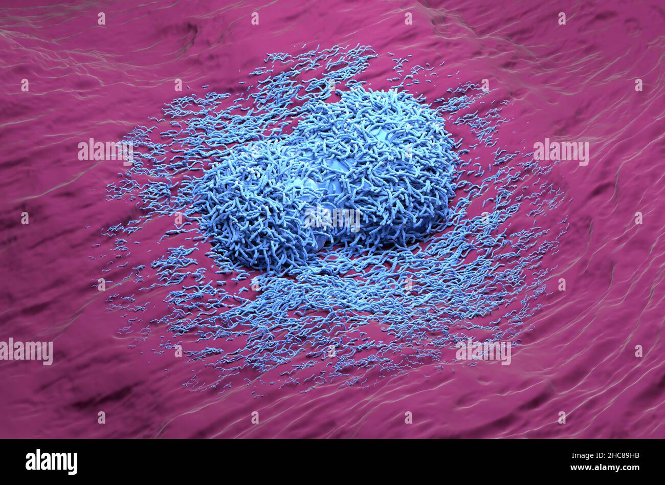 Liver cancer hepatoma blue color realistic isometric view 3d illustration Stock Photo