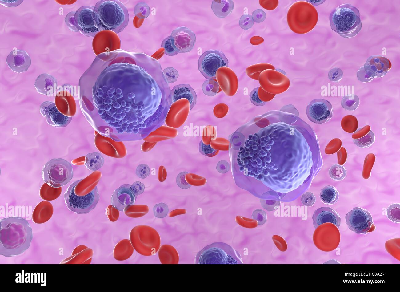 Acute myeloid leukemia (AML) cells in blood flow - isometric view 3d illustration Stock Photo