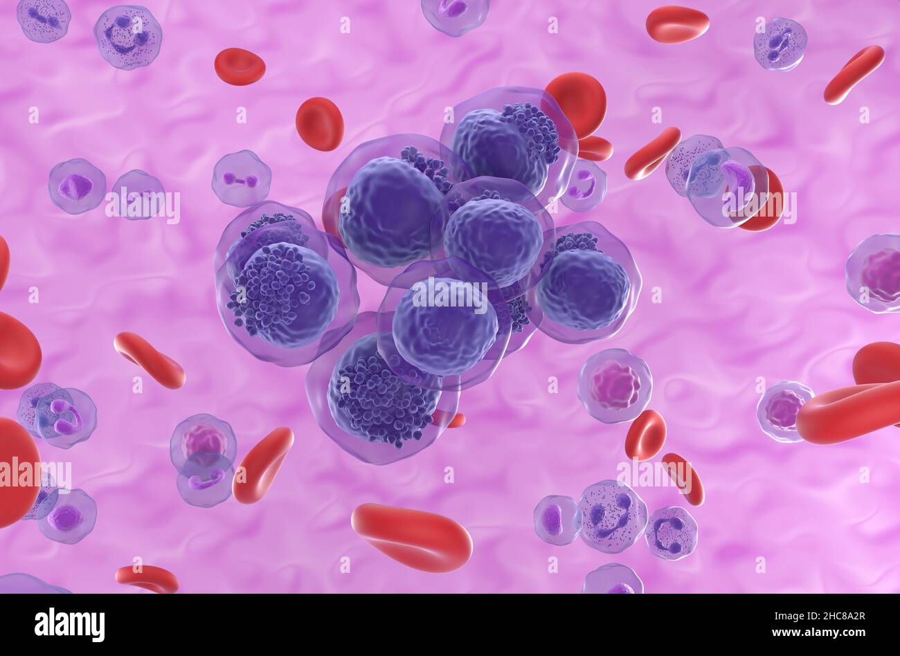 Acute myeloid leukemia (AML) cells cluster in blood flow - isometric view 3d illustration Stock Photo