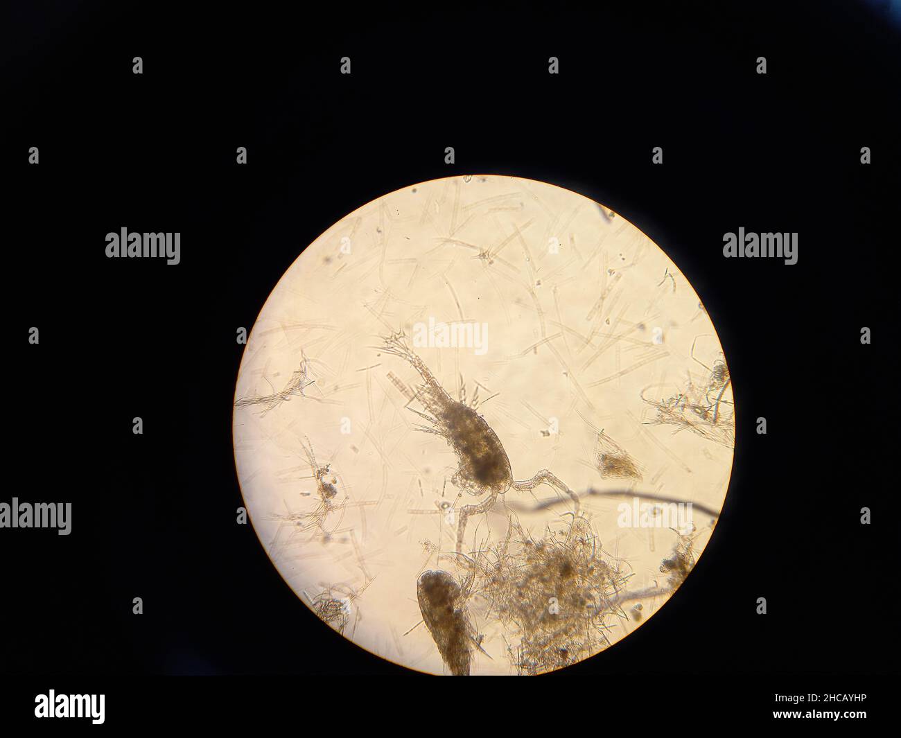 Inferior crustacean under the microscope magnification. High quality photo Stock Photo