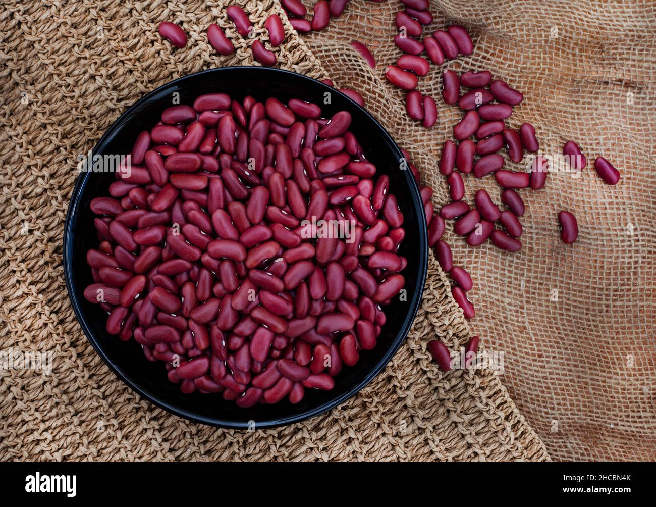 Kidney word hires stock photography and images Alamy