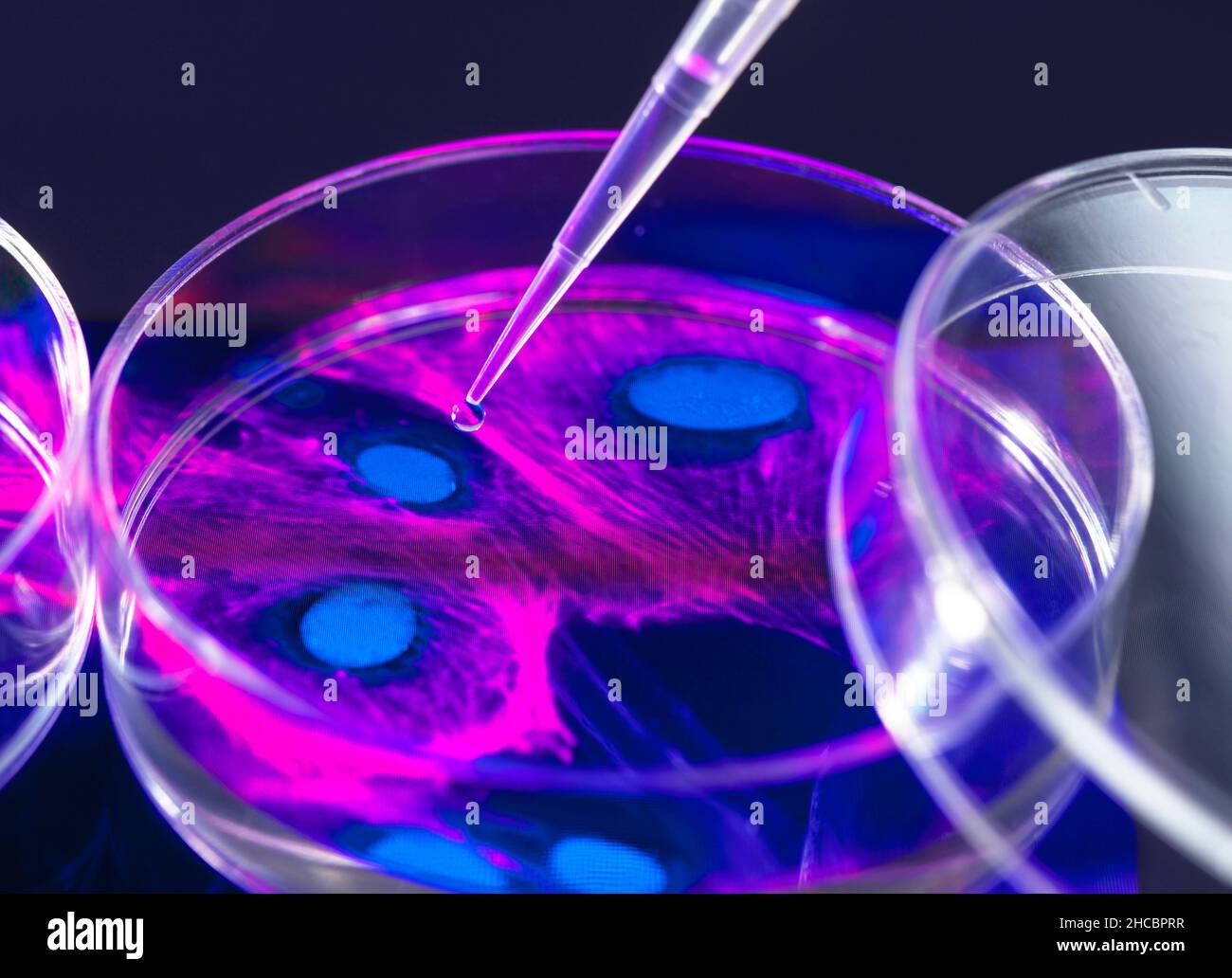 Pipetting of sample into Petri dish containing cell micrograph Stock Photo