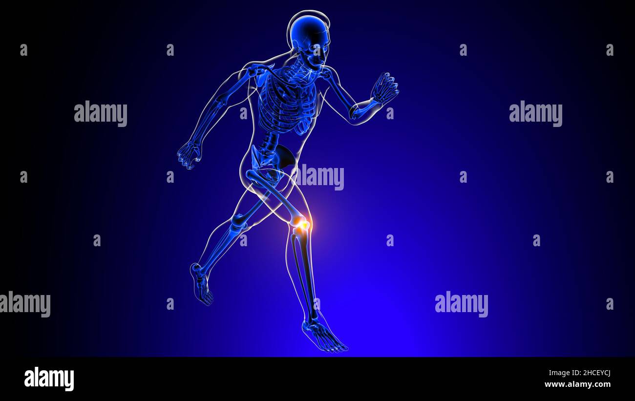 Knee joint pain Anatomy For Medical Concept 3D Illustration Stock Photo ...
