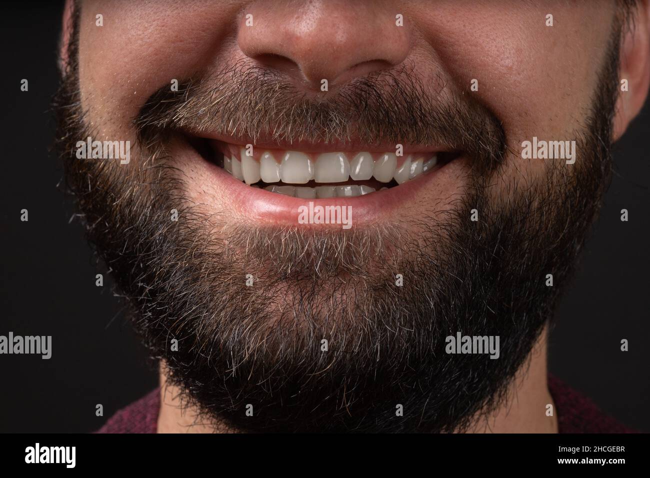 Close up view of beaming orthodontic white wide male smile, bearded man with healthy straight clean teeth isolated on black background, tooth health Stock Photo