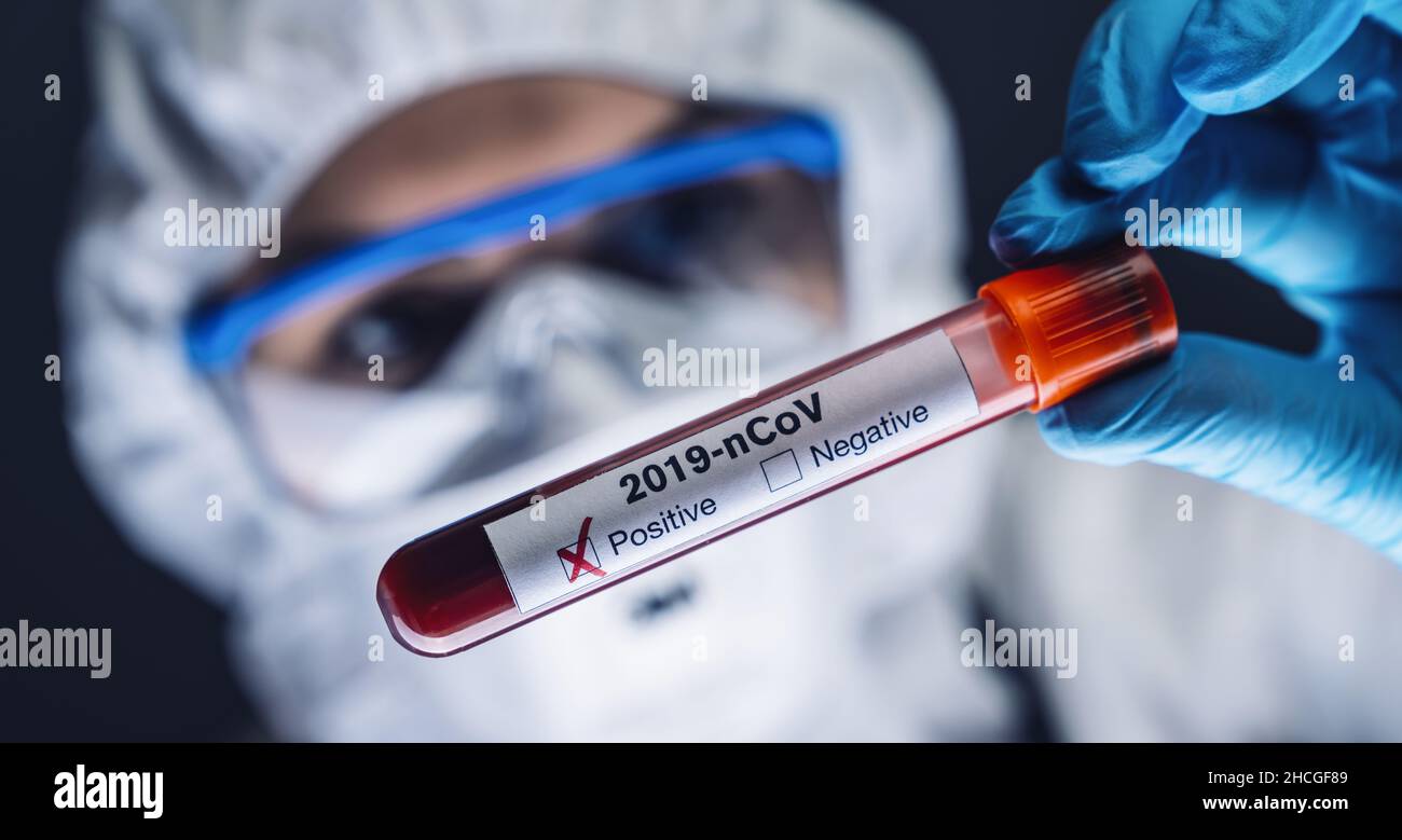 Positive case hi-res stock photography and images - Alamy