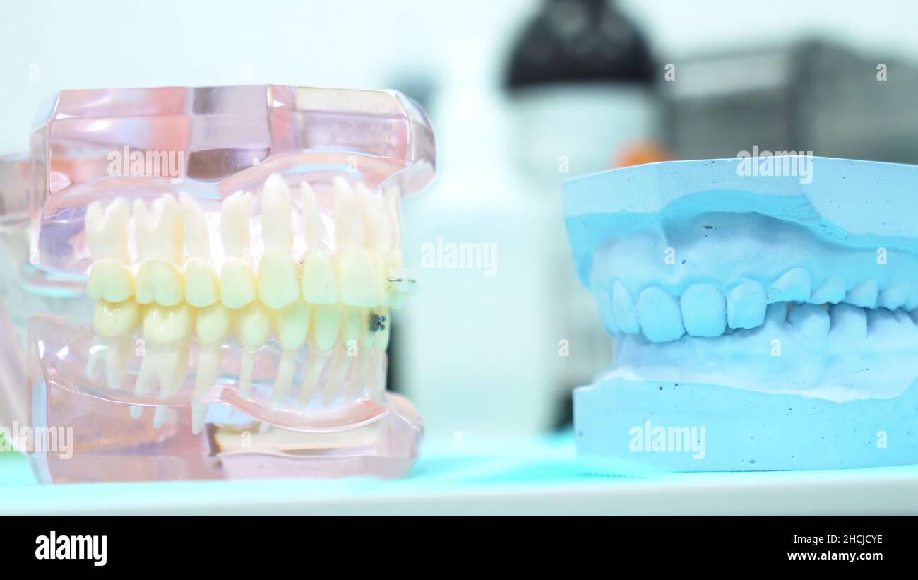 A model of the jaw on the table of the dental clinic, dental care and ...