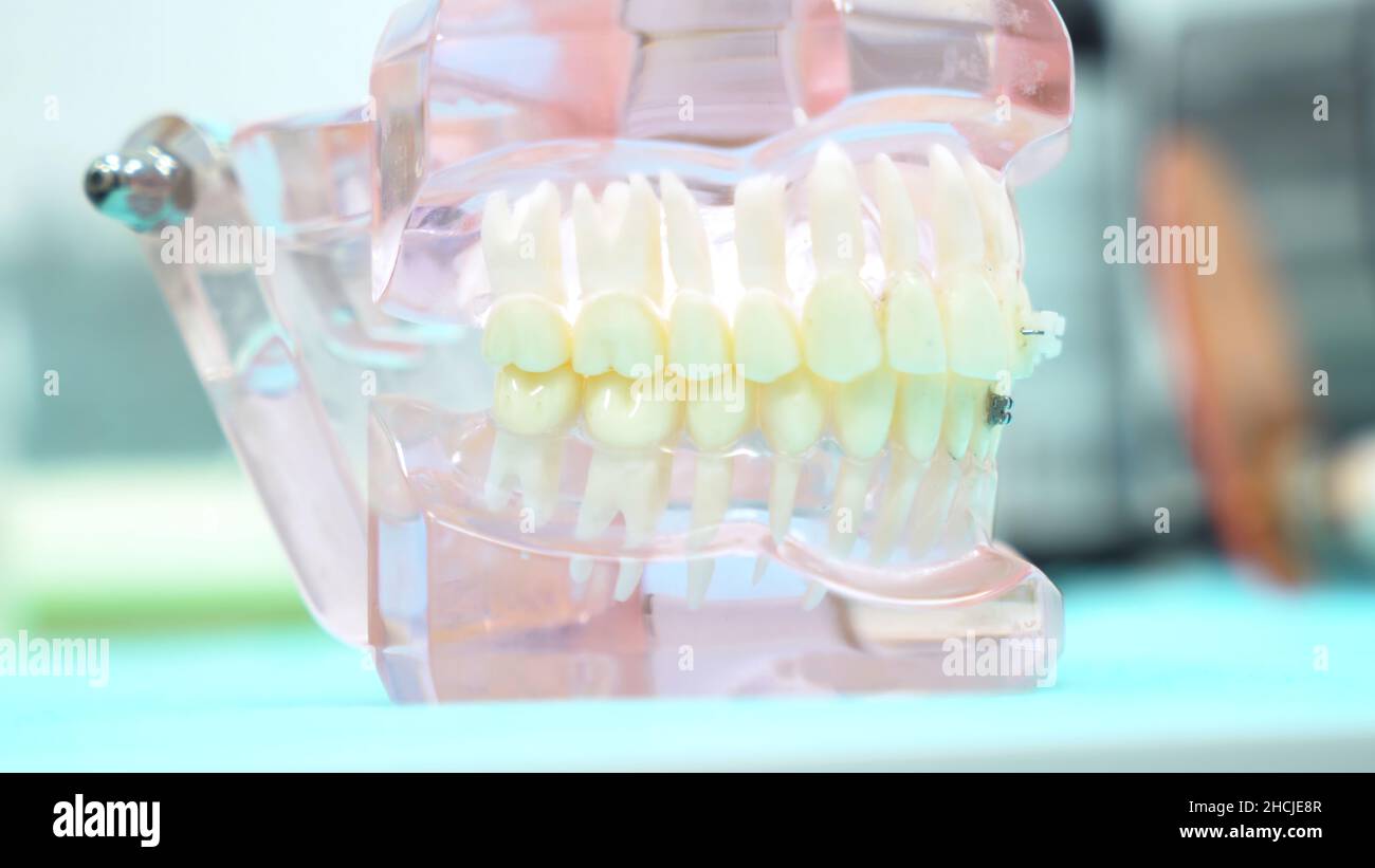 A model of the jaw on the table of the dental clinic, dental care and ...