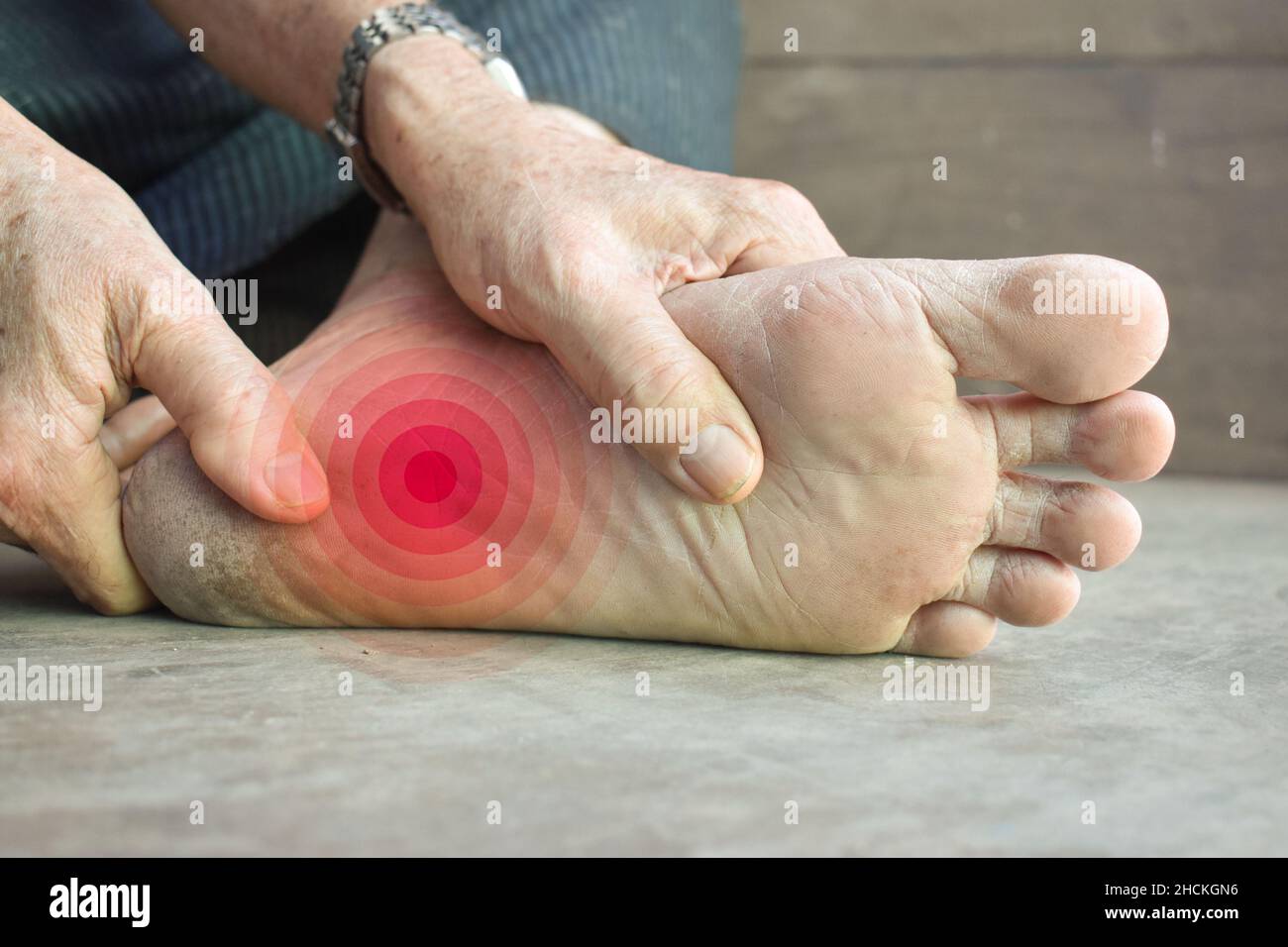 Tingling and burning sensation in foot of Asian old man with diabetes. Foot pain. Sensory neuropathy problems. Foot nerves problems. Plantar fasciitis Stock Photo