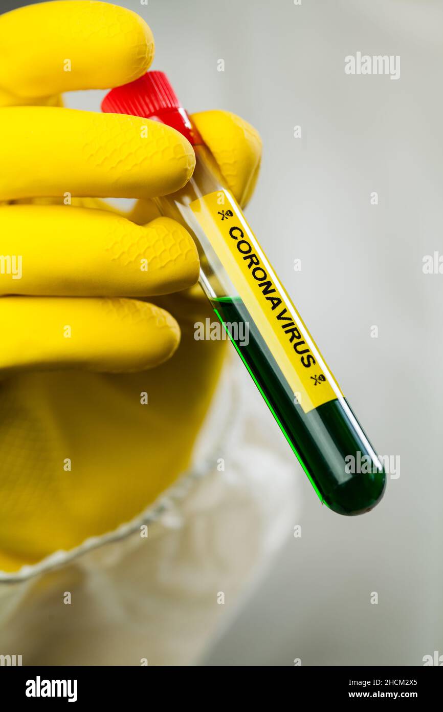 Scientist's hand in yellow protective glove holding test tube containing toxic green CORONAVIRUS ,highly contagious infectious COVID-19 virus disease Stock Photo