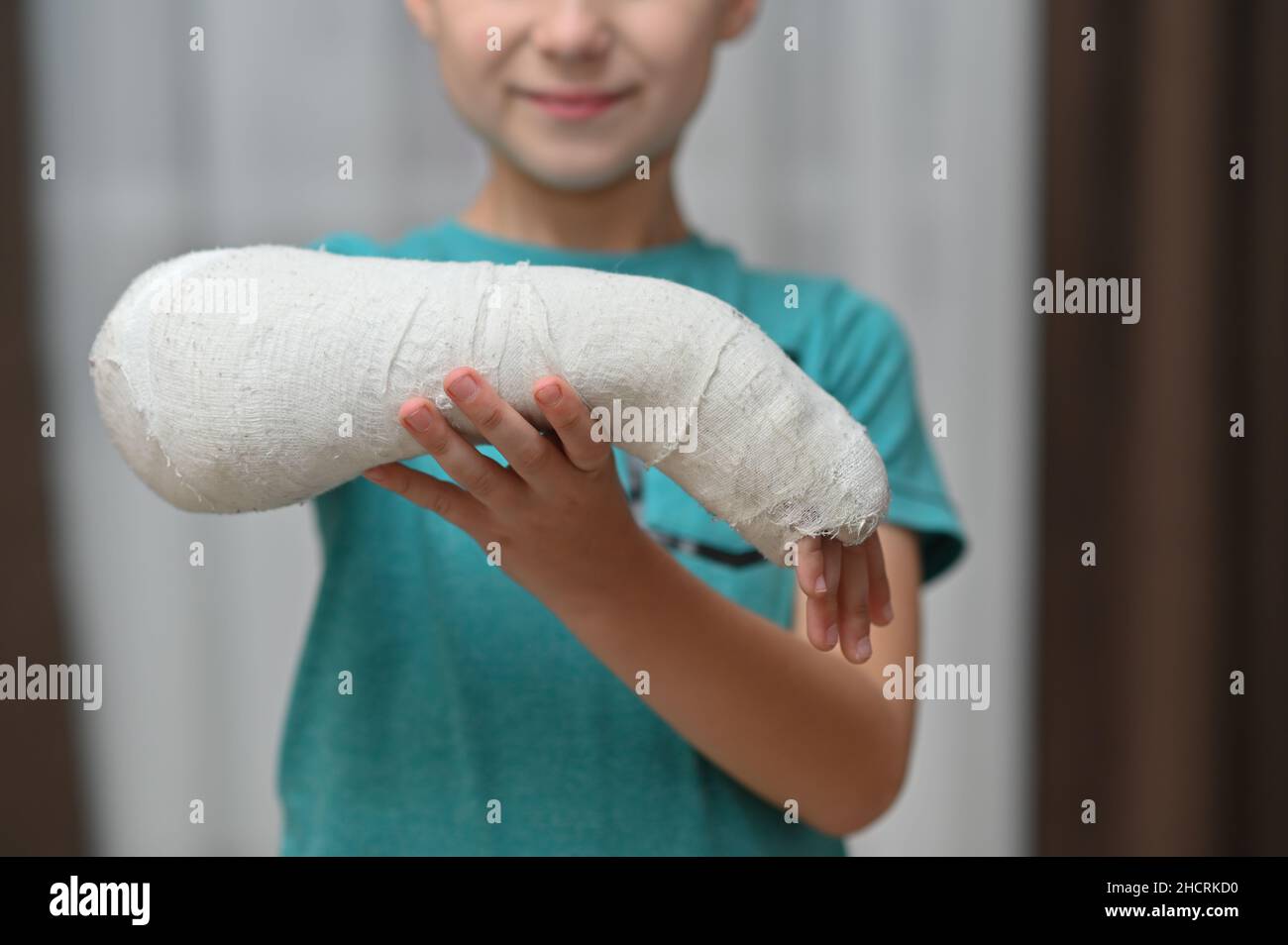 a boy with a broken arm in a cast. close-up. Stock Photo