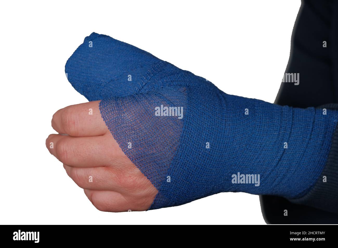 Bandaged hand isolated on white background. surgical bandage on the arm.Fractures,sprains and Bandages.Medicine. Surgical dressing. Broken arm. Stock Photo