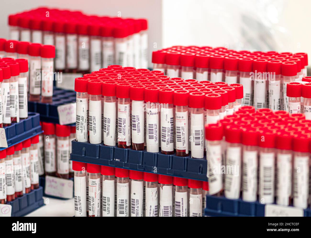 Real series of molecular PCR test tubes, nasal and oropharyngeal swabs