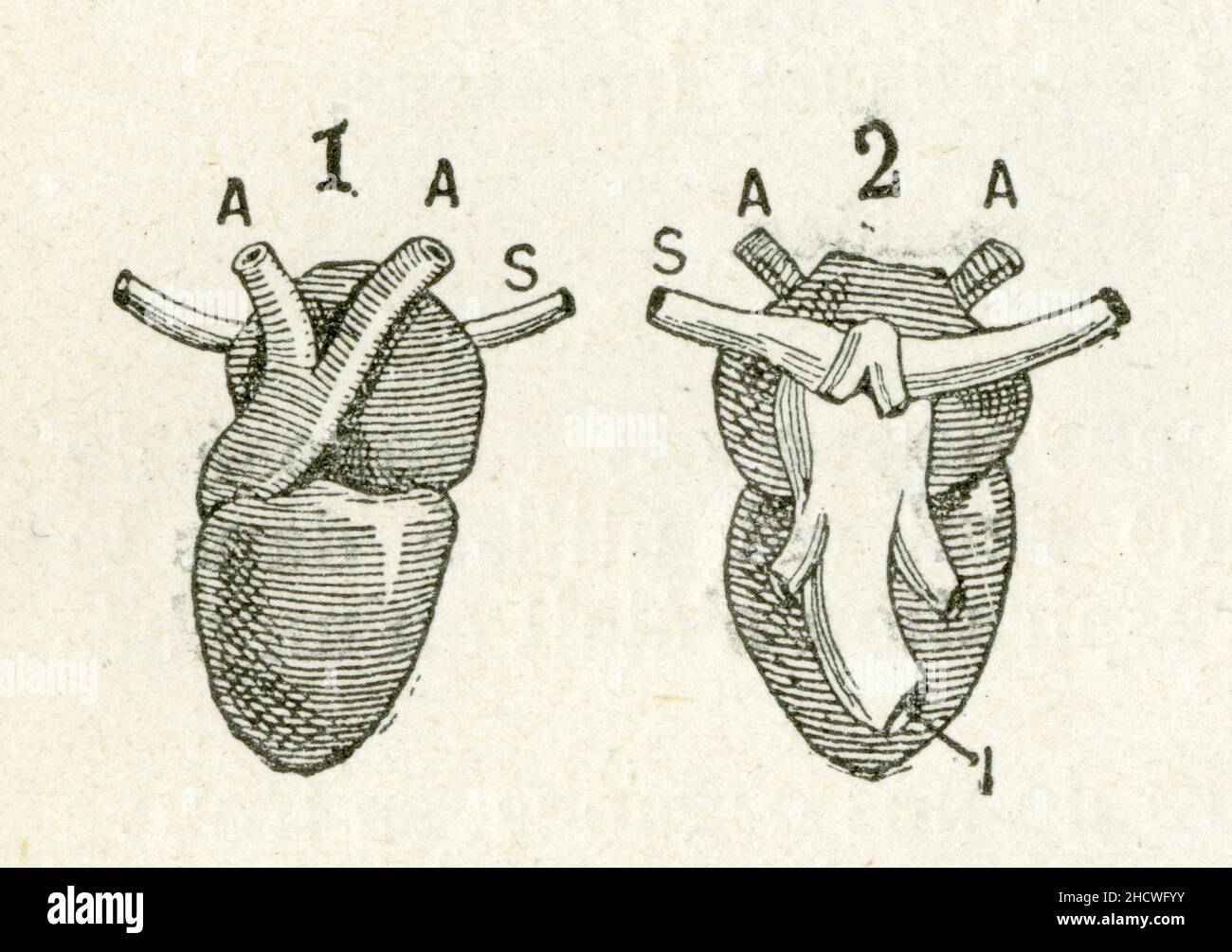 1.coeur de grenouille. 2.coupe. A,aorte. S,veine cave supérieure. I,veine cave inférieure Stock Photo
