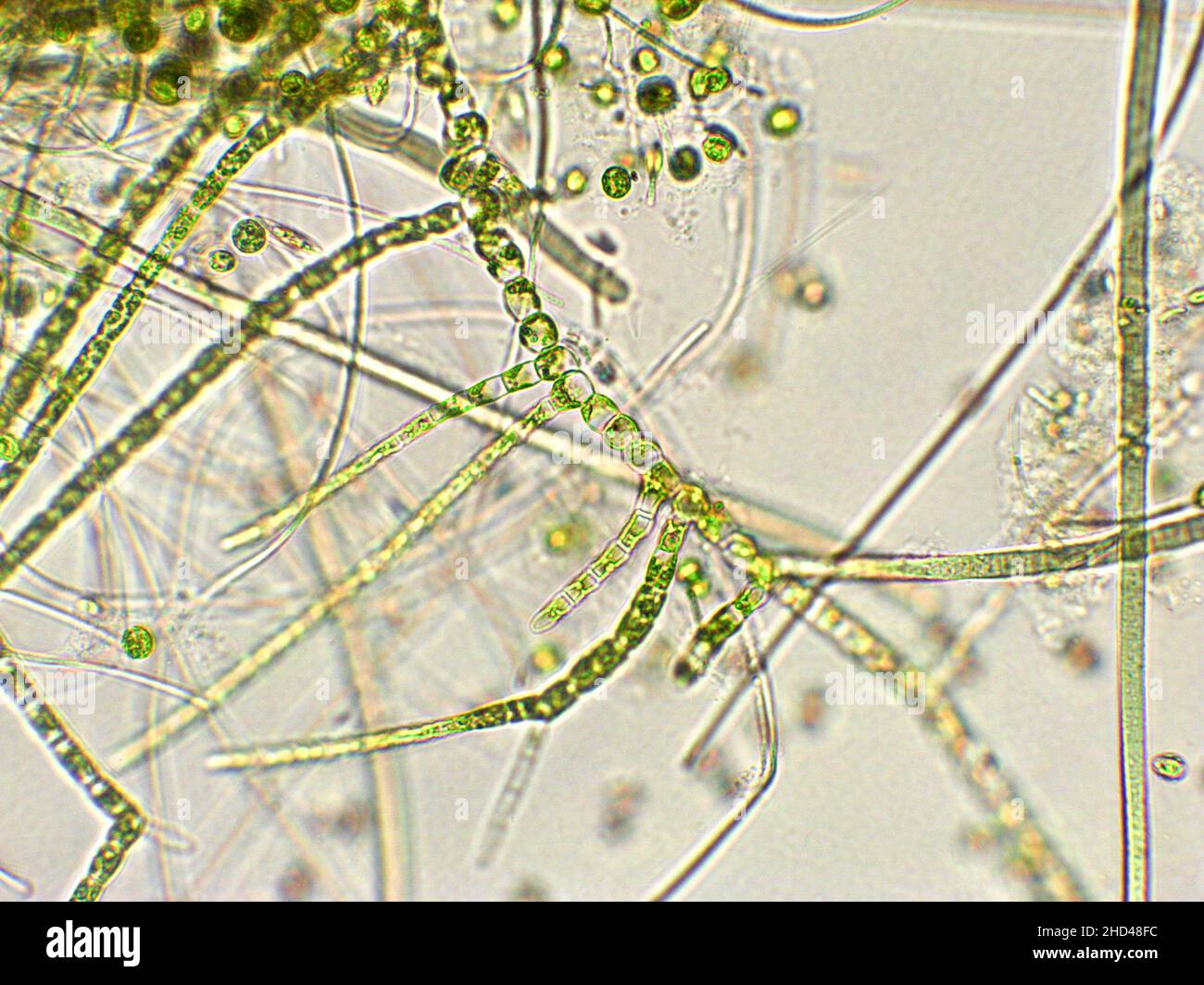 Green algae under microscopic view, freshwater under microscope Stock Photo