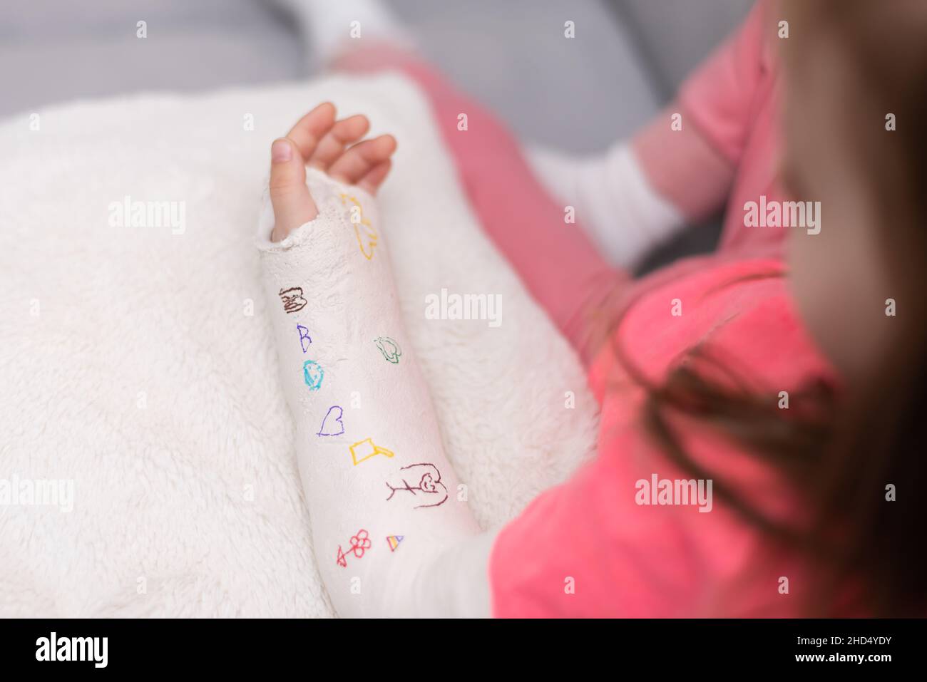 Girl's broken left arm has drawn a cute image on her arm on the plaster