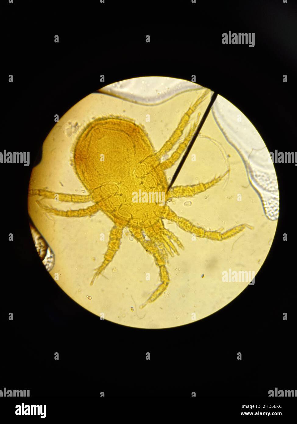 Ixodid tick under a microscope.  Stock Photo