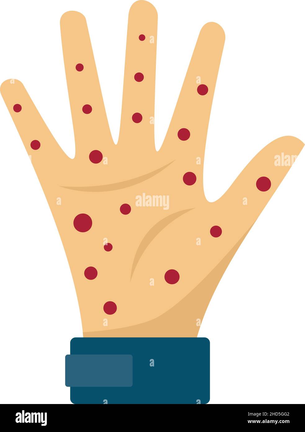 Hand measles icon. Flat illustration of hand measles vector icon isolated on white background Stock Vector