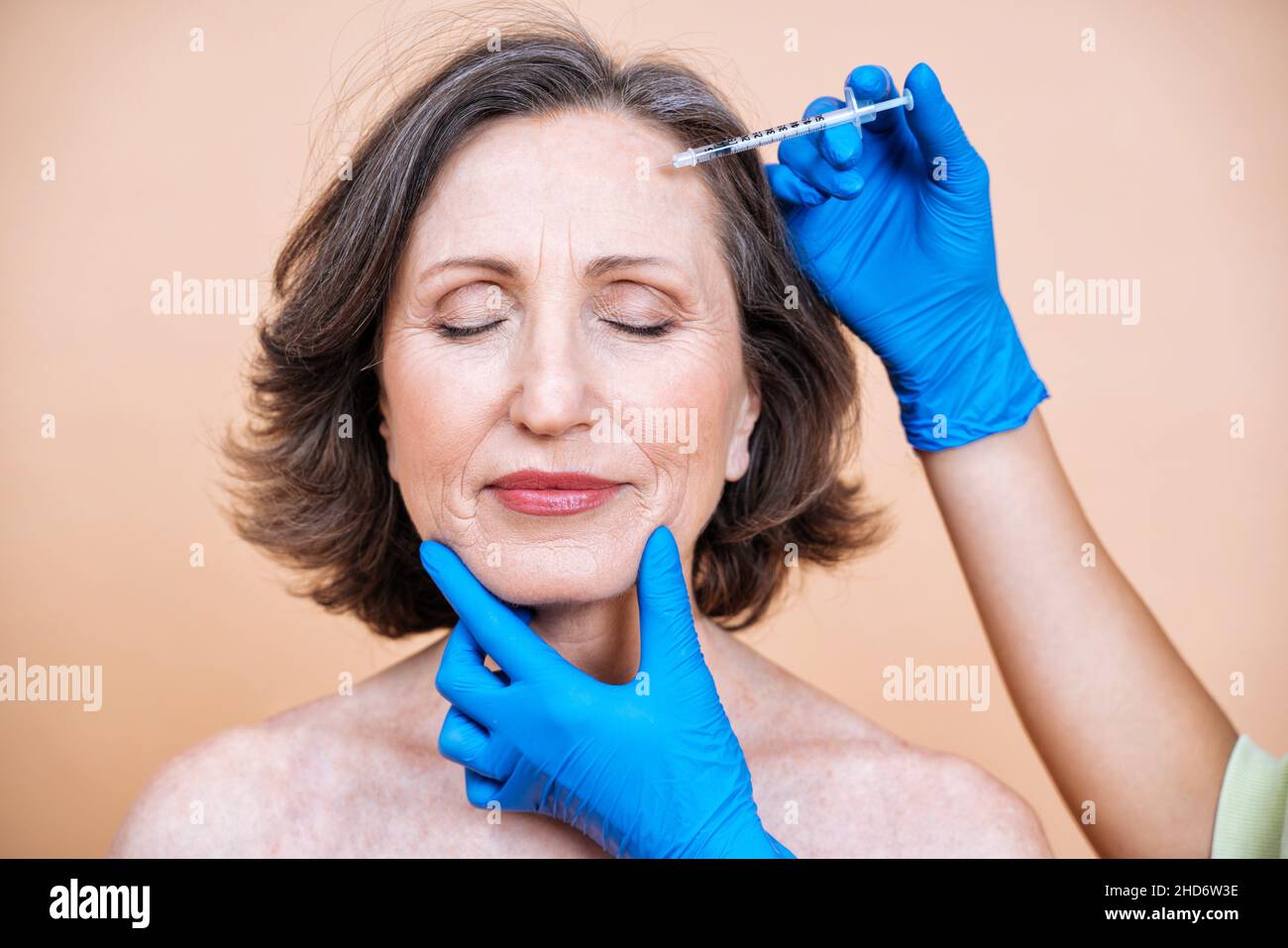 Filler surgery hires stock photography and images Alamy