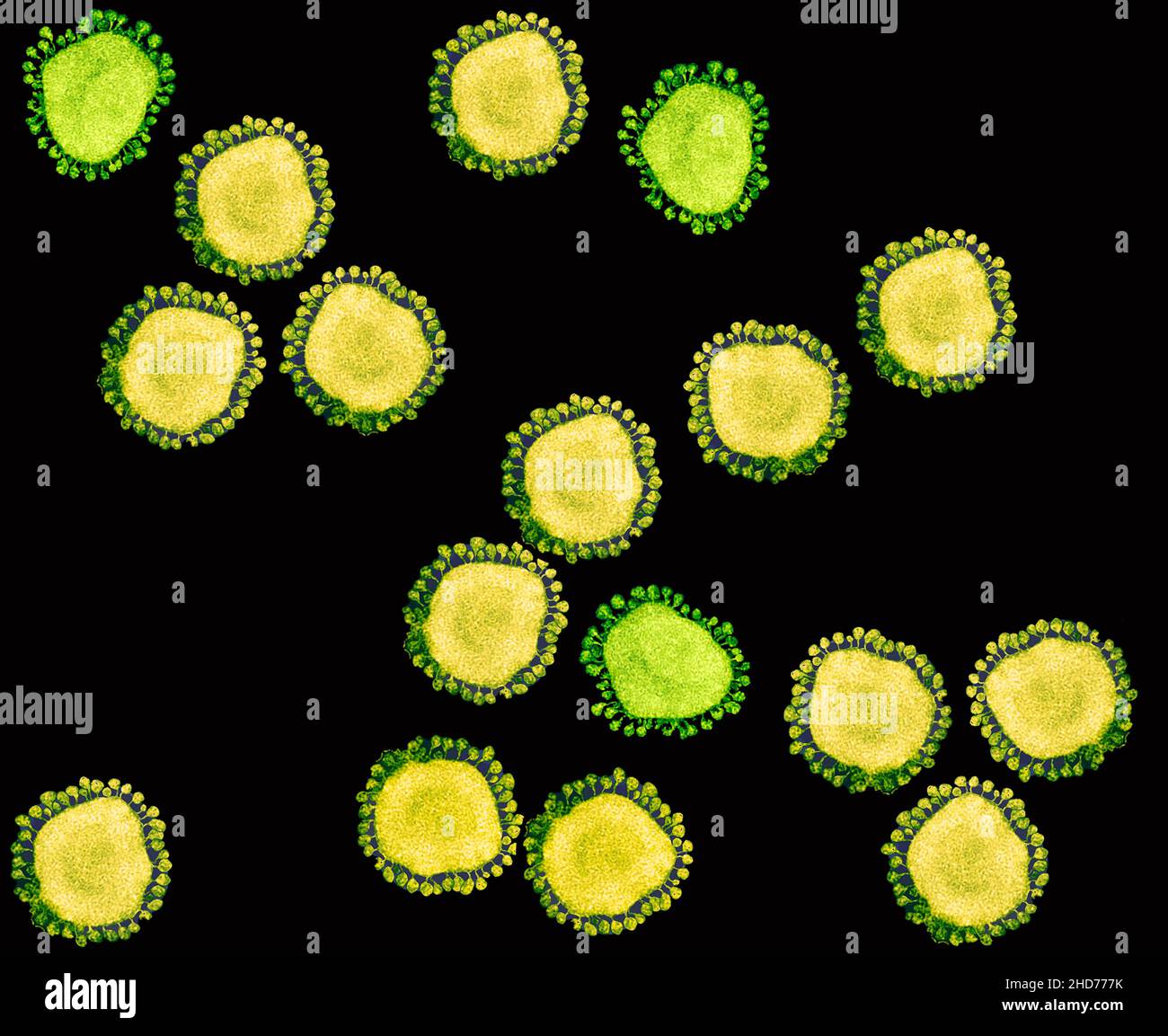 Purified coronavirus Covid-19 particles under transmission electron microscopy (TEM). Stock Photo