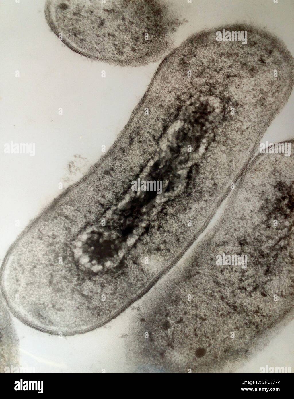 Cross section of Escherichia coli bacteria under transmission electron microscopy. Stock Photo