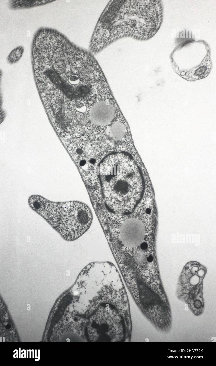 Cross section of Trypanosoma protozoan as seen under the electron microscope. Stock Photo