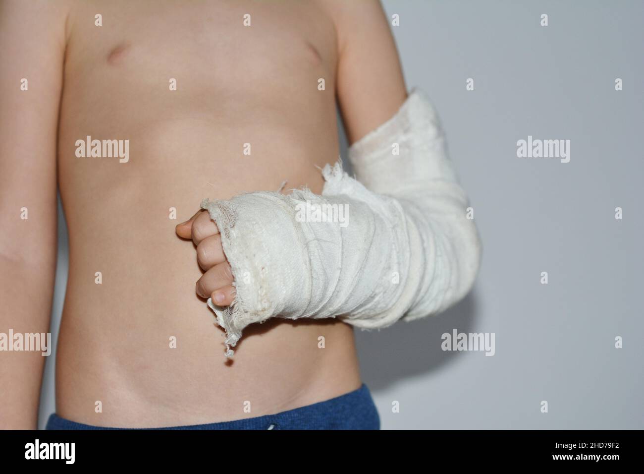 A boy with a broken hand in a cast from the wrist till the elbow is going to take a shower. Broken hand treatment. Stock Photo