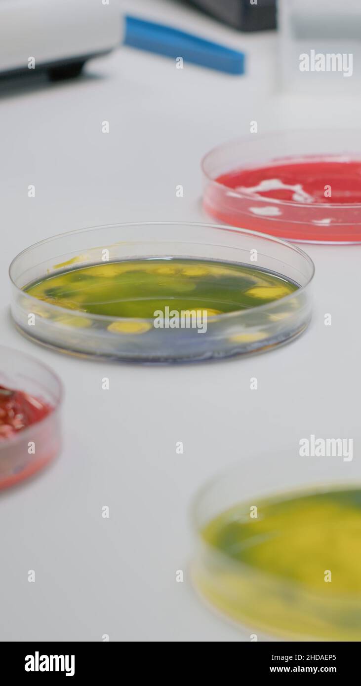 Petri Dish Use In Hindi at Marcelle Conner blog