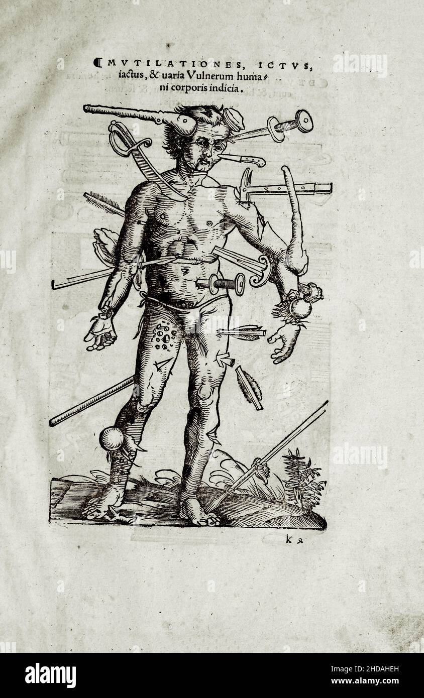 The 16th century illustration of surgery and surgical operations in the Middle Ages: Mutilationes, tap, bruise and different versions of the wounds of Stock Photo