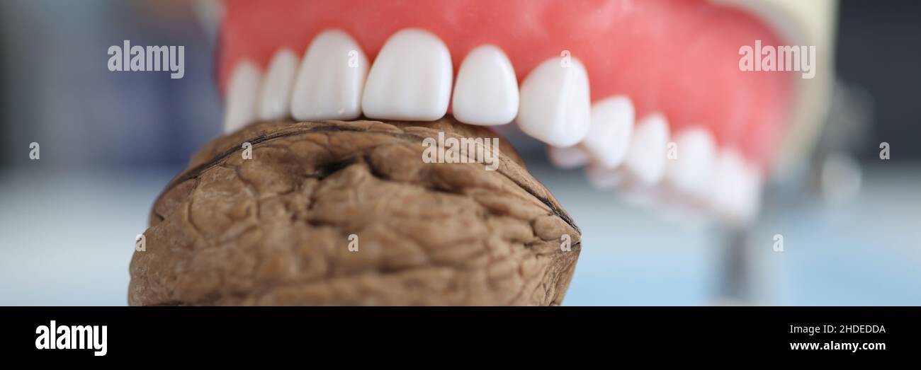 Artificial human jaw and walnut. Strong strong teeth Stock Photo